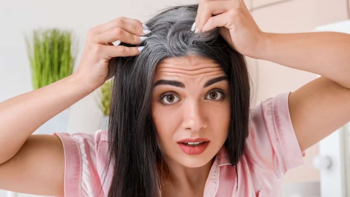 vyadhi_images/grey-hair-1-1682514382_n53x6LO.jpg